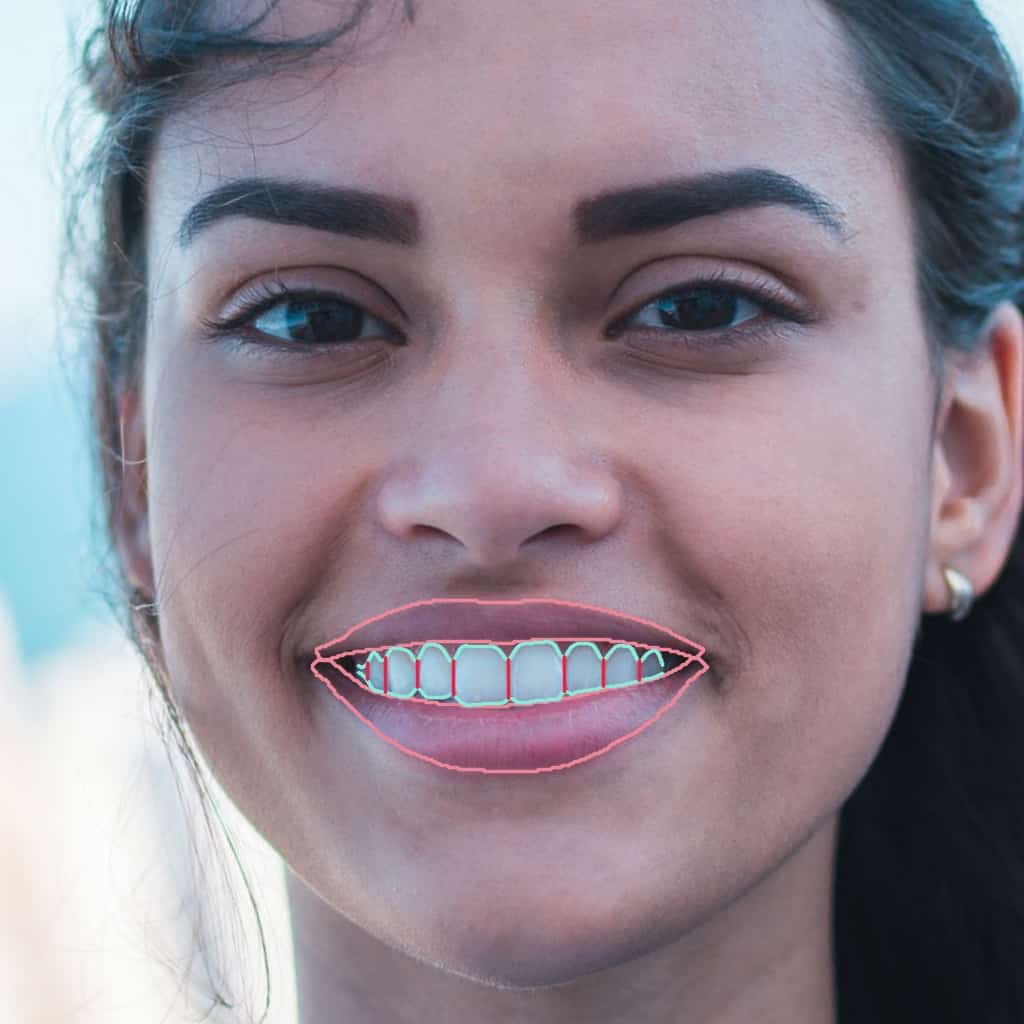 9-teeth____pexels-daniel-xavier-1102341