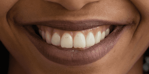 aligned_mouth
