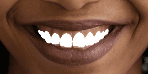 aligned_teeth