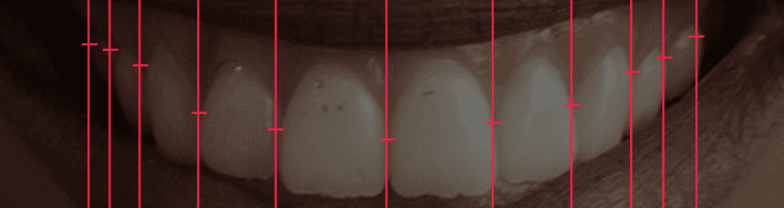 width_orig