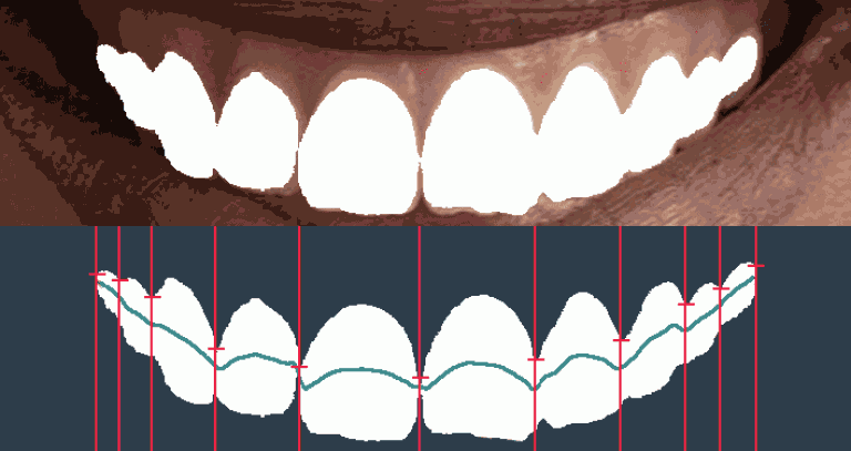 teeth_featured